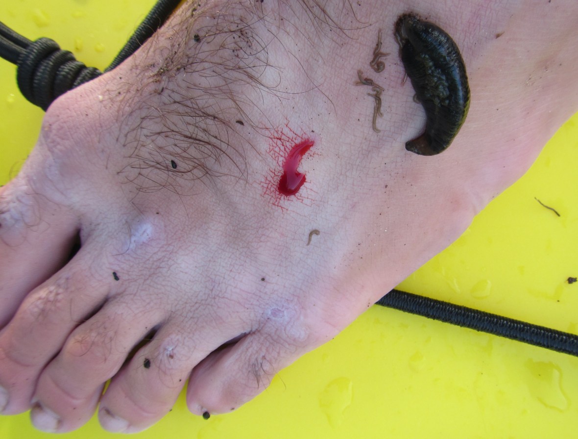 Yep, that's a leech and lots of little leeches.