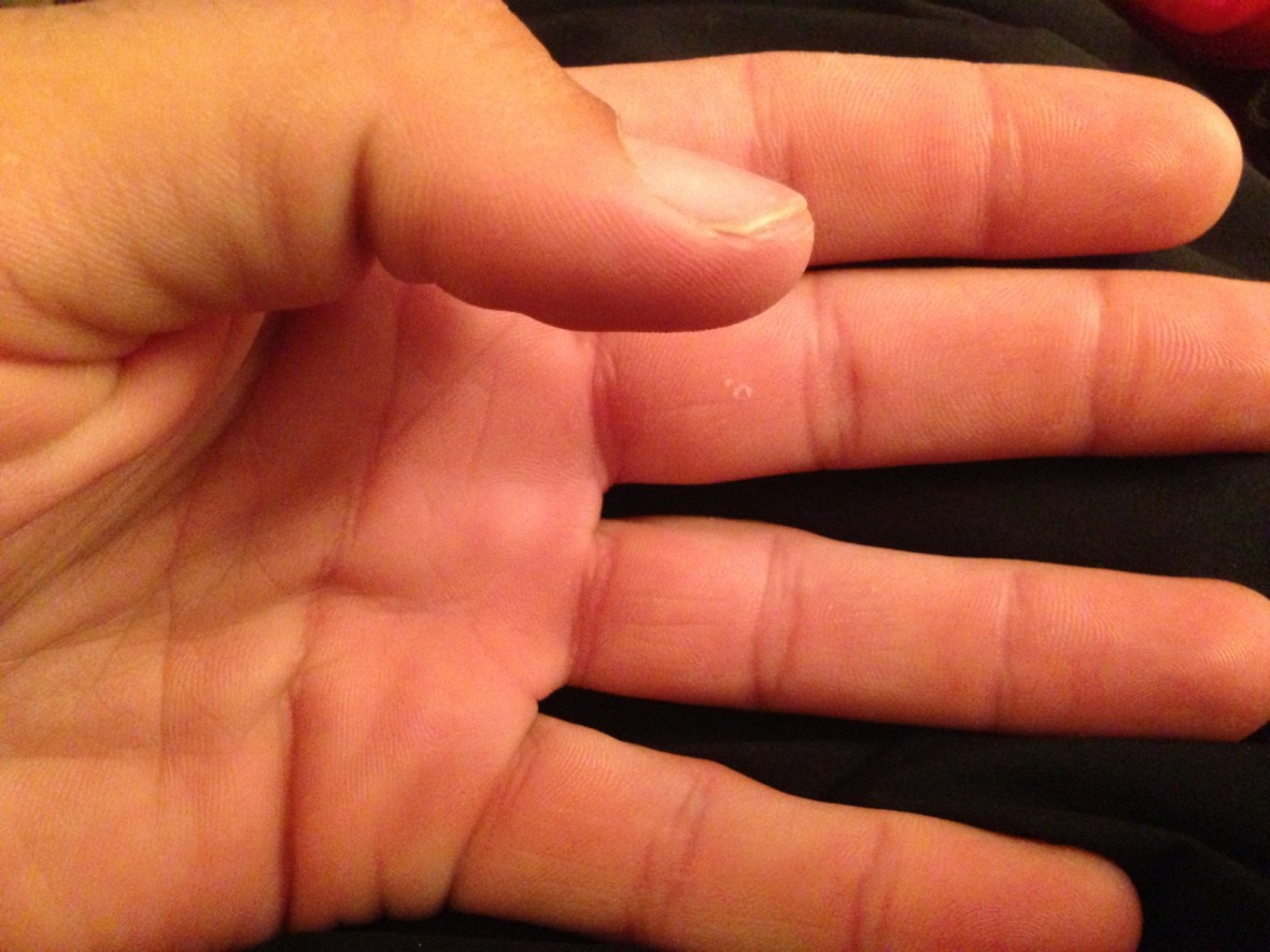 Hands